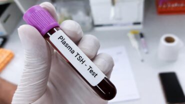 TSH analiz nə üçün verilir