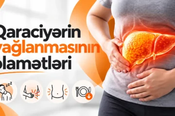 qaraciyər piylənməsi əlamətləri