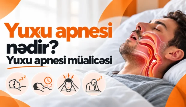 yuxu apnesi nedir ve mualicesi nece edilir